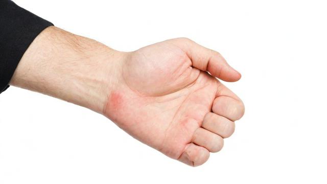 中指无名指解剖结构与疾病：分离手术及腱鞘炎的治疗全解析